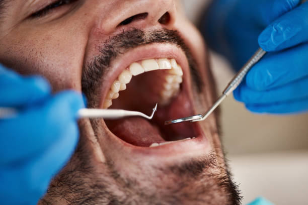 Best Dental X-Rays and Imaging  in Naples, TX